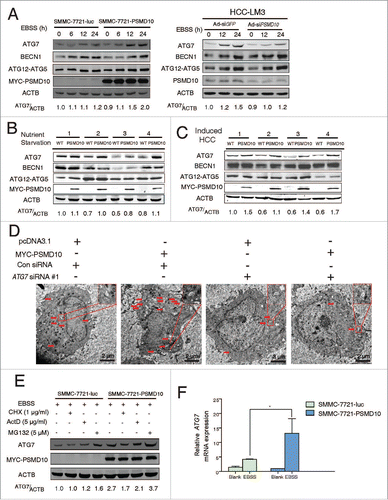 Figure 3. PSMD10 promotes ATG7 transcriptional activation. (A) Protein contents of ATG7, BECN1, ATG12–ATG5 conjugation, and PSMD10 were examined by immunoblot in SMMC-7721-PSMD10 versus SMMC-7721-luc cells, and HCC-LM3-Ad-siPSMD10 vs. Ad-siGFP cells after EBSS treatment for the indicated times. (B, C) The effect of PSMD10 on ATG7 expression was analyzed by immunoblot in vivo, including 24-h fasting (B) or DEN-TCPOBOP-induced HCC models (C). (D) Representative micrographs of autophagic vesicles or autophagosomes are shown in SMMC-7721 cells after transient cotransfection with pcDNA3.1 or MYC-PSMD10 and a nonspecific siRNA control or siATG7 RNA #1. (E) SMMC-7721-luc or SMMC-7721-PSMD10 cells were exposed to EBSS and cycloheximide (CHX, 1 μg/ml), actinomycin D (ActD, 5 μg/ml), or MG132 (5 μM) for 12 h. ATG7 was determined by immunoblot. (F) Quantitative PCR was performed to measure the transactivity of ATG7 in stable SMMC-7721-luc or SMMC-7721-PSMD10 cells exposed to EBSS for 24 h. Data represent the mean ± SD of 3 independent experiments (*P < 0.05).