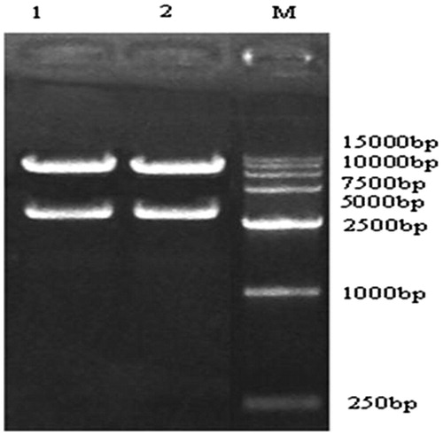 Figure 5. pAd-CaMKIIγ-shRNA digested. Lane 1, pAd-CaMKIIγ-shRNA-1 Lane 2, pAd-CaMKIIγ-shRNA-2.