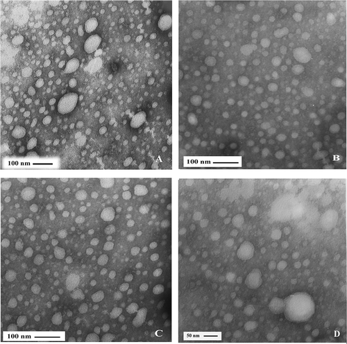 Figure 2 Electron micrograph of casein micelles in milk with 200,000 < SCC < 800,000 cells/ml. Bar in (A, B, C): 100 nm, Bar in D: 50 nm.