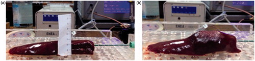 Figure 3. Thin sample of ex vivo porcine liver before (a) and after (b) a microwave thermal ablation (MTA) procedure.