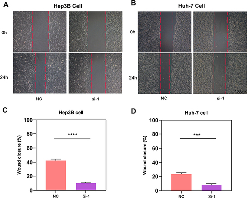 Figure 11 Results of wound-healing assays. (A and B) Results of wound-healing assays of Hep3B and Huh-7 cells under microscope. (C and D) Histogram comparing the results of wound-healing assays. ***p<0.001, ****p<0.0001.