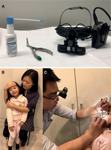 Figure 2 (A) From left to right: Co-phenylcaine™ Forte Spray, Killian nasal speculum and head light. (B) Correct way of cuddling child when removing NFBs. (C) Medical personnelߣs hands resting on the childߣs face while attempting removal of NFBs.