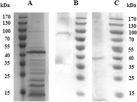 Figure 2. SDS-PAGE and immunobloting analysis of extracted proteins extracted from bacteria. (A) SDS-PAGE of soluble proteins extracted from bacteria; (B) Immunoblotting of mAb K13 for soluble proteins extracted from bacteria; (C) Immunoblotting of mAb K15 for soluble proteins extracted from bacteria.