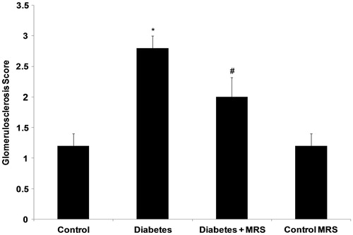 Figure 7. Glomerulosclerosis score in different experimental groups. Notes: Data are means (±SEM). *p < 0.05 versus control group; #p < 0.05 versus diabetes group; n = 6.