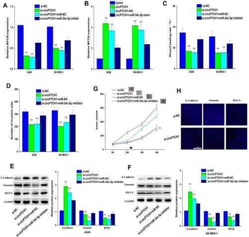 Figure 5 CircPTCH1 inhibits lung cancer cells migration, invasion and EMT by targeting MYCN via miR-34c-5p. (A, B) QRT-PCR analysis of the expression levels of MYCN in lung cancer cells after various treatments. (C, D) Wound healing and transwell assays showed the migration and invasion abilities of lung cancer cells after various treatments. (E, F) Western blot analysis the expression levels of MYCN, E-cadherin and Vimentin transfected with various treatments in A549 and SK-MES-1 cells. Data represent mean ± SD. **P < 0.01 compare with negative control. (G) BALB/c nude mice injected into A549 cells with various treatments. (H) E-cadherin, Vimentin, and MYCN in xenograft tumors were stained by immunofluorescent staining.