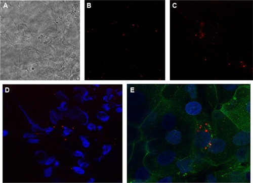 Figure 4 CLSM images of a cross-section of (A) corneal epithelium at depth of 10 μm, (B) pretreated with PLGA-PEG-HIV-Tat-Rho NPs, (C) pretreated with PLGA-PEG-POD-Rho NPs, (D) their corresponding phase contrast with nucleus, and (E) cell membranes.Abbreviations: CLSM, confocal laser scanning microscopy; HIV-Tat, human immunodeficiency virus transactivator; NPs, nanoparticles; PEG, polyethyleneglycol; PLGA, poly(lactic-co-glycolic acid); POD, peptide for ocular delivery; Rho, 5(6)-carboxytetramethylrhodamine.