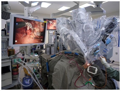Figure 2 View of the patient and the robotic arms during robotic radical tonsillectomy.
