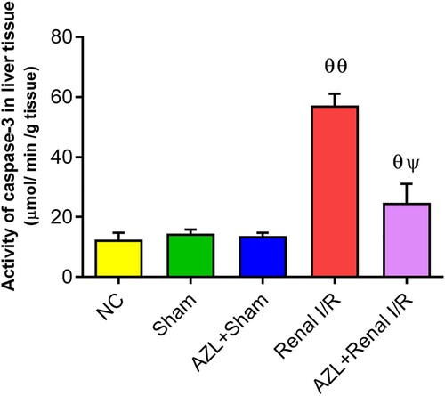 Figure 6. The effect of azilsartan (AZL, 3 mg/kg/day, PO for 7 days) on caspase-3 activity in livers of sham and renal ischemic rats. Each bar represents the mean ± SD of five rats per group; ϴp < 0.05, ϴϴp < 0.001 vs. NC and sham control groups; ΨP < 0.001 vs. Renal I/R group.