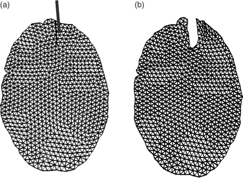 Figure 10. (a) The initial mesh with the cut. (b) The final mesh. The deformation is the result of applying the displacements due to brain shift and retraction to the biomechanical model using XFEM.