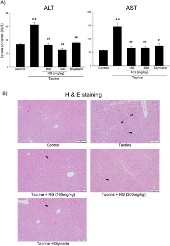 Figure 7 Effects of RG on Tacrine-induced liver injury in rats. 100 and 300 mg/kg RG or 200 mg Silymarin were orally administrated to rats for three consecutive days. Subsequently, 30mg/kg tacrine was injected orally. (A) Serum ALT and AST level in rats confirmed the effect of RG on liver injury. The data represent the mean ± S.E.M. (**p < 0.01 between the vehicle control; ##p < 0.01, #p < 0.05 between tacrine treatments). (B) Histo-chemical analysis of liver tissue in rats was performed by H&E staining (bar = 200μm). Arrows indicate the degeneration of hepatocytes.