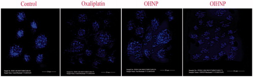 Figure 2. Morphological nuclear staining by DAPI for nanoparticulate formulations comparable to control and oxaliplatin.