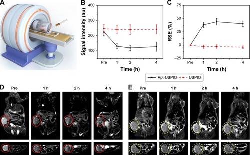 Figure 8 In vivo MRI of xenograft tumors. (A) In vivo T2-weighted MRI of the HCC xenograft models after injection of USPIO or Apt-USPIO. (B) T2-weighted MR signal intensities of the Huh-7 tumors significantly decrease in the experimental (Apt-USPIO) group as compared to the control (USPIO) group. (C) RSE values in the experimental group are significantly higher than the control group at different time points. (D) Coronal and axial T2-weighted MR images of tumor-bearing mice before and after intravenous injection show significant negative enhancement of the tumors (red circles) at different time points in the Apt-USPIO group. (E) There is no decline in the signal intensities of the tumors (yellow circles) in the corresponding USPIO group.Abbreviations: Apt-USPIO, aptamer-mediated USPIO; HCC, hepatocellular carcinoma; MRI, magnetic resonance imaging; RSE, relative signal enhancement; USPIO, ultrasmall superparamagnetic iron oxide.