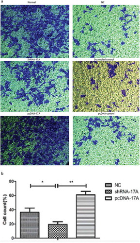 Figure 3. 17A knockdown inhibited the migration of SH-SY5Y cells. (a) Representative images of SH-SY5Y cell migration; (b) The percentage of migrated cells was significantly lower in cells transfected with shRNA-17A, in comparison with that of NC (p < 0.05) and that of pcDNA-17A transfection (p < 0.01). (*p < 0.05, **p < 0.01).