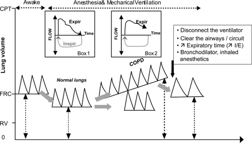Figure 2 Progressive hyperdynamic inflation in COPD patients during mechanical ventilation and its treatment.