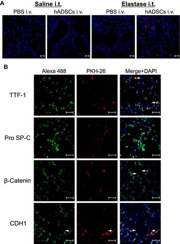 Figure 4 Fluorescence staining of epithelial markers in the lungs.