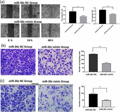 Figure 3. Overexpression of miR-30 c inhibits SNU449 cell migration and invasion. (a) Scratch assay and (b) Transwell assay to detect SNU449 cell migration ability. (c) Transwell assay (containing matrix gel) to detect SNU449 cell invasion ability