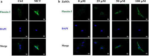 Figure 1. Representative zinc probe fluorescence images in PASMCs. a Elevated intensity of fluorescent indicator which reflects intracellular free zinc levels in MCT-PASMCs compared with control (n = 3). b Elevated intensity of fluorescent indicator which reflects intracellular free zinc levels in PASMCs in response to increased ZnSO4 concentration in medium (n = 3). Ctrl: control; MCT: PASMCs isolated from MCT-PAH rats. Scale bar = 25 μm.