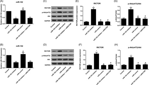 Figure 6. Comparison of expression of miR-152, RICTOR and downstream proteins in osteoblasts from each group. Note: A, B, The expression of miR-152 in primary osteoblasts (A) and MC3T3-E1 cells (B) detected by qRT-PCR; C, D, The expression of RICTOR and p-Akt (s473)/Akt in primary osteoblasts (C) and MC3T3-E1 cells (D) evaluated by Western blot; E, F, The expression of RICTOR in primary osteoblasts (E) and MC3T3-E1 cells (F) in each group; G, H, Comparison of p-Akt(s473)/Akt levels in primary osteoblasts (G) and MC3T3-E1 cells (H) among groups; *p< 0.05 compared with Control group; #p< 0.05 compared with miR-152 inhibitor group.