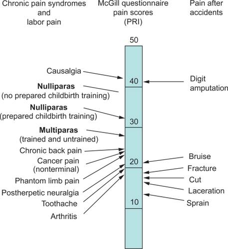 Figure 1 Comparison of pain scores using the McGill Pain Questionnaire obtained from women during labor and from patients in general hospital clinics and an emergency department. The pain rating index (PRI) represents the sum of the rank values for all words chosen from 20 sets of pain descriptions. From Melzack R. The myth of painless childbirth [The John J. Bonica Lecture]. Pain. 1984;19(4):321–337.Citation4 Copyright © 1984. This figure has been reproduced with permission of the International Association for the study of Pain® (IASP®). The figure may not be reproduced for any other purpose without permission.