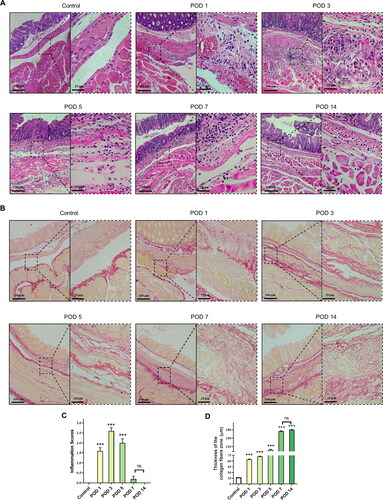 Figure 5. Degree of inflammation and collagen deposition in injured peritoneum and adhesion. (A) Histological observation of peritoneal tissues at different time points (100×; inset, 400×). (B) Representative images showing picrosirius red staining (100×; inset, 400×). (C) Inflammatory scores at different time points based on histology (n = 10; compared with the control group, *P < 0.05, ***P<0.001). (D) Thickness of the collagen fiber zone in the adhesion tissue (n = 10; compared with the control group, *P < 0.05, ***P<0.001).