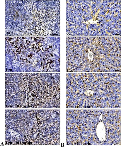 Figure 5 Immunohistochemistry results show protein distribution of NF-κB p65 in the (A) spleen and (B) liver of ENU-induced leukemic mice. Scale bar= 50 µm, Magnification= 400 ×.