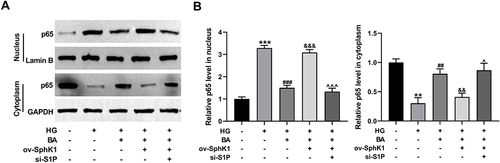 Figure 9 BA suppresses HG-induced p65 nuclear translocation in HK-2 cells by the SphK1/S1P pathway. (A and B) HK-2 cells transfected with ov-SphK1 or ov-SphK1+si-S1P were treated with HG or HG+BA. (A) NF-κB p65 protein levels in the nucleus and cytoplasm were detected by immunoblotting assay, with Lamin B and GAPDH as the nuclear and cytoplasmic controls, respectively. (B) Quantitative analysis of NF-κB p65 protein levels in the nucleus and cytoplasm. **P<0.01 and ***P<0.001 vs control; ##P<0.01 and ###P<0.001 vs HG treatment; &&P<0.01 and &&&P<0.001 vs HG+BA treatment; ^P<0.05 and ^^^P<0.001 vs ov-SphK1+HG+BA treatment.