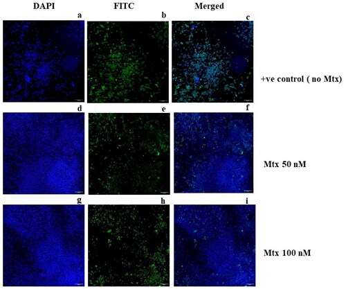 Figure 14. Effect of Methotrexate on HEV Replication using IFA. The cells were infected with the virus without an inhibitor as a positive control; panel (a) represents huh-7 cells stained with DAPI, (b) represents huh-7 cells stained with FITC, and (c) represents the merged image of DAPI and FITC. In another experiment, cells were similarly treated with the virus with an addition of 50 nM Mtx, where (d) represents huh-7 cells treated with DAPI, (e) represents FITC-treated cells, and (f) represents the merged image of DAPI and FITC. Further, in a similar experiment, the cells were treated with 100 nM of Mtx, and the panels (g), (h), and (i) represent DAPI, FITC, and merged images, respectively.