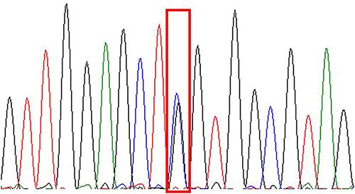 Figure 11 KRAS-Ex2 c.34G>C (p.G12R).