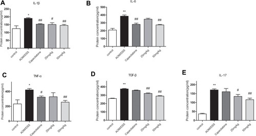 Figure 4 Inhibition Effect of HLJ2 on inflammatory factors in AOM/DSS-induced CAC mice. ELISA results of colons of all groups: (A) IL-1β, (B) IL-6, (C) TNF-α, (D) TGF-β, (E) IL-17. HLJ2 effectively inhibited secretion of IL-1β, IL-6, TNF-α, TGF-β, and IL-17. *P < 0.05, **P < 0.01 compared with control group; #P < 0.05, ##P < 0.01 compared with AOM/DSS group. Mean values ± SEM are shown (n=10).