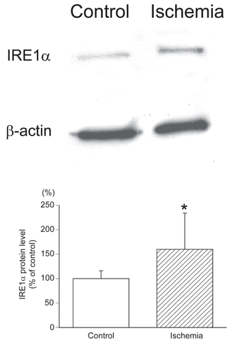 Figure 4 Western blot analysis of IRE1α protein levels in ischemic retinas. In the ischemic retinas, the IRE1α protein level was significantly increased compared to that of the control retinas (100 ± 15.9% of control versus 159.9 ± 73.9% of control, P = 0.0369 by Mann-Whitney U test). All densitometric values for western blot analysis were normalized with β-actin signals.