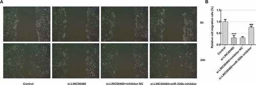 Figure 7. MiR-320b dowregulation partly reversed the effect of LINC00460 knockdown on the migration of SW1990 cells. (a–b) The migration of SW1990 cells transfected with si-LINC00460, si-LINC00460+ inhibitor-NC or si-LINC00460+ miR-320b-inhibitor was detected by wound-healing assay. Error bars represent the mean ± SEM from three independent experiments. ***P< 0.001 vs. Control. ###P< 0.001 vs. si-LINC00460