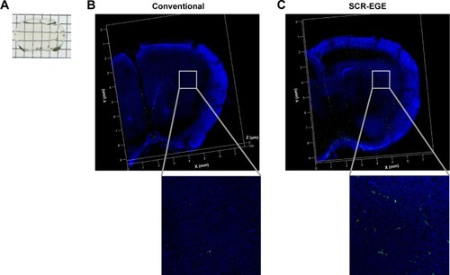 Figure 5 Distribution of transgene expression in the brain.Notes: Observation of the ZsGreen1 distribution in the brain using tissue clearing. Mice were transfected with conventional or SCR-EGE bubble lipopolyplexes carrying pZsGreen1-N1 under the following conditions: ultrasound duration, 10 s; intensity, 1 W/cm2; pDNA dose; 50 μg. Twenty-four hours after transfection, mice were fixed and cleared using CUBIC (A–G), ScaleSQ (H–J), or ClearT2 (K–M). Transmission color images of the brain after tissue clearing using CUBIC (A), ScaleSQ (H), or ClearT2 (K) are shown. Confocal microscopy images of brains transfected with conventional (B, I, L) or SCR-EGE bubble lipopolyplexes (C, J, M) are shown. The transmission color images and confocal microscopy image of the lungs and liver cleared with CUBIC are shown as control organs (D–G). Green, red, and blue signals indicate ZsGreen1 expression, DiI-labeled blood vessels, and DAPI staining, respectively. Arrows denote ZsGreen1 expression outside of blood vessels.Abbreviations: CUBIC, clear, unobstructed brain imaging cocktails; DAPI, 4′,6-diamidino-2-phenylindole; DiI, 1,1′-dioctadecyl-3,3,3′,3′-tetramethylindocarbocyanine perchlorate; EGE, echo gas encapsulation; pDNA, plasmid DNA; SCR, surface charge regulation; SCR-EGE, SCR-based EGE.