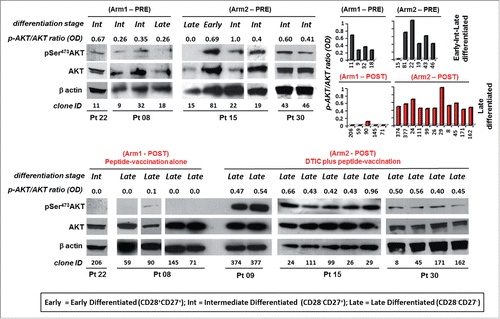 Figure 2. Melan-A-specific CD8+ T cells isolated after combined chemoimmunotherapy display pSer473-AKT expression unrelated to their differentiation stage. Analysis of AKT activation by Western blot in terms of phosphorylation of Ser473 (pSer473-AKT) and total AKT expression tested on whole cell extracts of 1.5 ×106 viable Melan-A specific clones (n = 26), isolated before (PRE) and after treatment (POST) with vaccination alone (Arm1) or DTIC plus vaccination (Arm2), 18 h following activation by plate-coated anti-CD3 mAb plus rIL-2. Gel loading control was performed analyzing β actin expression. The differentiation status (based on the expression of CD28 and/or CD27 co-stimulatory molecules, see Table 1) for each clone is reported. Cells isolated from patients before the treatments evidence an expression of pSer473-AKT which relates with the differentiation status. Cell clones isolated after therapy (POST) are late differentiated (defined by the lack CD28 and CD27 molecules). Cells isolated from Arm1 (Arm1-POST) do not express pSer473-AKT according to their late differentiated profile, differently clones isolated from Arm2 patients (Arm2-POST) display a strong pSer473-AKT expression. Densitometric quantification (OD) of protein bands was determined by NIH ImageJ software and expressed p-AKT/AKT ratios are expressed either as numbers and columns.