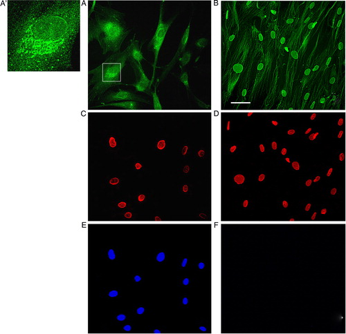 Figure 2. The glutathionylation process is strictly associated with the nuclear lamina and the cytoskeleton. Epifluorescence analysis of control unextracted (A, C, E) and extracted fibroblasts (B, D, F) using GS-Pro (A, B) and lamin B (C, D) antibodies. In normal conditions, glutathionylated proteins were concentrated around nuclei, interspersed in subcellular compartments, and in correspondence to cytoskeletal filaments (A). Immunolabeling of structures like cisternae was observed in several cells (inset in A, high magnification in A′). After matrix extraction, that preserves nuclear lamina and cytoskeleton and dissolves cytosol, organuli, ER cisternae, nucleoplasm and DNA, samples showed a clear and brilliant staining of cytoskeletal filaments and of the nuclear rim (B), as supported by double labeling with lamin B antibody (D). Hoechst staining for nuclei (E, F) was negative in extracted cells treated with DNAse (F), following DNA digestion. Scale bar, 50 µm.