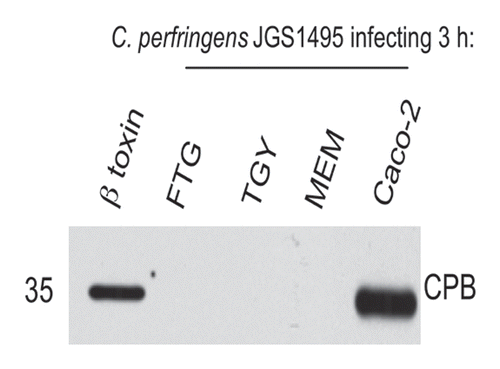 Figure 2 The presence of host cells affects the kinetics of β-toxin accumulation in supernatants of type C isolate JGS1495. Equal number of JGS1495 cells were inoculated into a tissue culture dish containing bacterial culture media [either fluid thioglycollate broth (FTG) or tryptic soy broth-glucoseyeast extract (TGY)] tissue culture medium [minimal essential medium (MEM)], or MEM containing Caco-2 enterocyte-like cells. After 3 h incubation at 37°C, each culture was harvested and the culture supernatant was subjected to western blotting using an anti-β-toxin monoclonal antibody. Used with permission from Vidal et al.Citation11