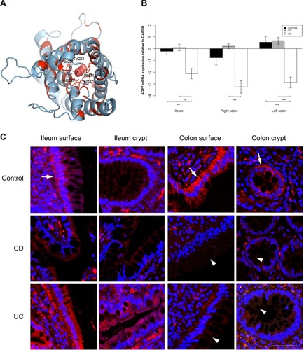 Figure 3 AQP7 expression is reduced in the ileum and colon of UC patients.