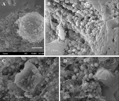 Figure 5 SEM images of (A): cultured CNPs from a serum sample, (B, C, and D): CaP spheres detected on renal papilla (Randall’s plaque). Bars; 2 μm.