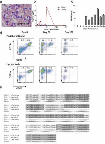 Figure 5. Treatment of patient 429–006 with cCD20-BB-ζ CAR T cells