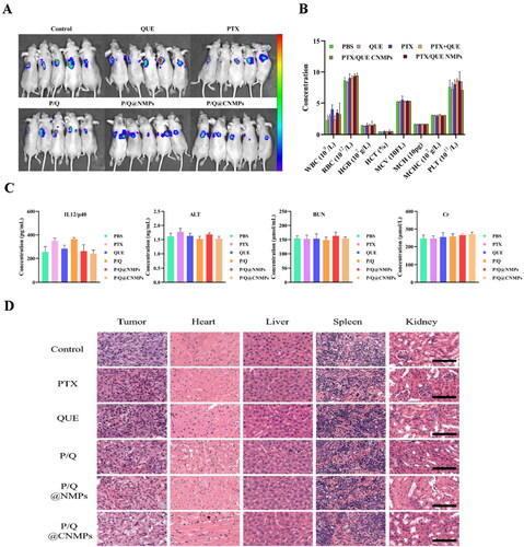 Figure 6. In vivo evaluation of anti-tumor efficacy. (A) Representative NIRF photographs of mice tumors after 21-day treatment; (B) Hematological analysis (WBC, RBC, PLT, HGB, HCT, MCV, MCH, and MCHC), (C) blood biochemical analysis (IL 12/p40, ALT, BUN, Cr), and (D) H&E stained histological sections, including tumor, heart, liver, spleen, and kidney, after treatment with PBS, pure PTX, pure QUE, the mixture of PTX and QUE, P/Q@NMPs, and P/Q@CNMPs, respectively. (n = 5) Scale bar 100 μm.Abbreviations: WBC, white blood cell; RBC, red blood cell; PLT, platelet; HGB, hemoglobin; HCT, hematocrit; MCV, mean corpuscular volume; MCHC, mean corpuscular hemoglobin.