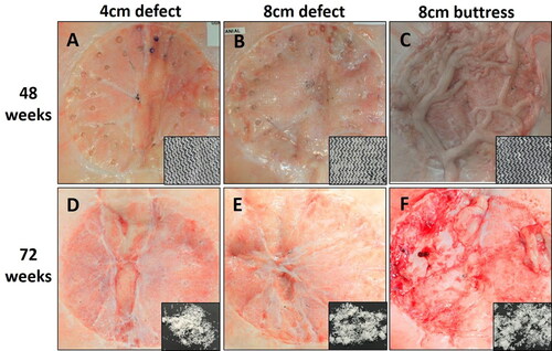 Figure 4. Phasix™ ST Mesh at 48 weeks (top row) and 72 weeks (bottom row) postimplantation. Inset photos depict Phasix™ ST Mesh after collagenase digestion of adherent native tissue. Phasix™ ST Mesh remained intact at 48 weeks, but only low molecular weight fragments remained at 72 weeks.