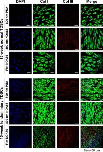 Figure 4 Expression of type I and type III collagen was observed in the TDSCs extracted from 15-week normal and 15-week tendon injury models cultured on the 800 nm NOA86 (2.4 GPa), flat NOA86, and 800 nm PUA (19.8 MPa) substrates.Notes: In the 15-week normal tendon model, expression of type III collagen was high in TDSCs cultured on the 800 nm NOA86 substrates. In the 15-week tendon injury model, expression of type III collagen was similar irrespective of nanotopographic cues and substrate stiffness. The expression of type I collagen was not different between nanotopographic cues and substrate stiffness in the 15-week normal and tendon injury models.Abbreviations: Col I, type I collagen; Col III, type III collagen; NOA86, Norland Optical Adhesive 86; PUA, polyurethane; TDSCs, tendon-derived stem cells.