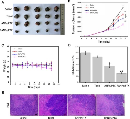 Figure 9 The antitumor efficacy of PTX-loaded nanoparticles in C57BL/6 mice bearing B16F10 melanoma xenografts. (A) Images of excised B16F10 tumors collected from each treatment. (B) Average tumor volumes after treatment over the investigative period (n = 5). *p < 0.05 vs Taxol, #p < 0.05 vs ANPs/PTX. (C) Bodyweight variations of mice bearing B16F10 melanoma xenografts after each treatment over time. (D) Tumor inhibition rate after treatment. (E) Morphology of RANPs/PTX-treated groups. Sections were isolated and stained with hematoxylin and eosin (H&E) for histopathological analysis. Scale bar represents 100 μm. Data represent means ± SD (n = 5).