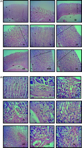 Figure 3. (A) Microscopic analysis at the ×10 magnification of the rat stomach pre-treated with the respective test solution followed by the ethanol-induced gastric ulcer formation. (i) Gastric tissue of normal (untreated) group shows mucosa layer (M) consist of gastric glands, which extend from the level of muscularis mucosa (MM) to open into the stomach lumen via gastric pits (GP). (ii) Gastric tissue of vehicle (negative control)-treated group shows a total disruption of the epithelial layer (EL) of the mucosa and GP. (iii) Gastric tissue of 100 mg/kg ranitidine (positive control)-treated group shows the irregular architecture of the epithelial surface of mucosa, which is still in the recovery phase. (iv) Gastric tissue of 50 mg/kg CEMC-treated group shows the total disruption of EL indicated by the slough off of the mucosa lining that had occurred in a few places. Structure of GP was also disrupted and the mucosa layer show presence of inflammatory cells. (v) Gastric tissue of 250 mg/kg CEMC-treated group shows that the EL is undergoing recovery indicated by the tissue architecture that resemble the normal lining of stomach. The cells in the mucosa were not disrupted as the lesions on the surface are fewer. (vi) Gastric tissue of 500 mg/kg CEMC-treated group shows that the EL lining the stomach was almost in its normal form and lesions are hardly found at the mucosa layer. (vii) Gastric tissue of 50 mg/kg CEMM-treated group shows mild disruption of the EL with the slough off of the surface of the mucosa. Edema is present at the MM layer. (viii) Gastric tissue of 250 mg/kg CEMM-treated group shows that the mucosa layer is highly populated with H and N. Morphology of the cells were also changed and did not resemble normal structure of cells. (ix) Gastric tissue of 500 mg/kg CEMM-treated group shows improvement in the structure of the mucosa with the morphology of the cells resembles those of the normal untreated cells. The surface of EL shows better lining at the top of mucosa layer (Hematoxylin & eosin; magnification ×10). (B) Microscopic analysis at the ×40 magnification of the rat’s stomach pre-treated with the respective test solution followed by the ethanol-induced gastric ulcer formation. (i) Gastric tissue of normal (untreated) group shows that the gastric glands contain mixed population of cells such as parietal cell (P), which is acid-secreting cells and chief cells (C) that are located towards the bases of the gastric glands. Mucus will line the GP in which gastric gland will open. (ii) Gastric tissue of vehicle (negative control)-treated group shows a high number of neutrophils (N) and hemorrhage (H) within the mucosa layer. (iii) Gastric tissue of 100 mg/kg ranitidine (positive control)-treated group shows the presence of inflammatory exudates mainly N and mild H within the mucosa layer. (iv) Gastric tissue of 50 mg/kg CEMC-treated group shows the presence of H and N, which can be seen clearly and mostly reside at the base of the mucosa layer. (v) Gastric tissue of 250 mg/kg CEMC-treated group also shows that N were present at the base of the mucosa layer with the absence of H. (vi) Gastric tissue of 500 mg/kg CEMC-treated group shows normal structure of the P and C cells with the absence of H and inflammatory exudates. (vii) Gastric tissue of 50 mg/kg CEMM-treated group shows the presence of H and N, which were found mainly at the base of the mucosa layer. (viii) Gastric tissue of 250 mg/kg CEMM-treated group shows the presence of low number of N and H that were mainly located at the base of mucosa layer. (ix) Gastric tissue of 500 mg/kg CEMM-treated group shows the least number of N and H, and the lining of the mucosa had almost the same architecture as the normal stomach (hematoxylin & eosin; magnification ×40).