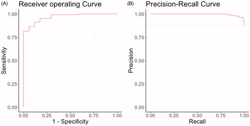 Figure 2. (A) Receiver operating curve and (B) Precision-Recall curves of NLP algorithm for multiple bone metastases in the independent testing set, n = 141. NLP: natural language processing.