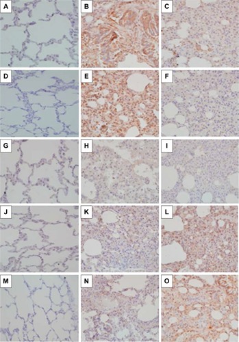 Figure 4 Effect of simvastatin on protein synthesis of MMPs and TIMPs.