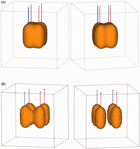 Figure 8. (A) 3D representation of 50°C isotherm after 7 min of RFA applying 50 W with an inter-electrode distance of 2 cm (left: front view; right: side view). (B) 3D representation of 50°C isotherm after 7 min of RFA applying 50 W with an inter-electrode distance of 3 cm (left: front view; right: side view).
