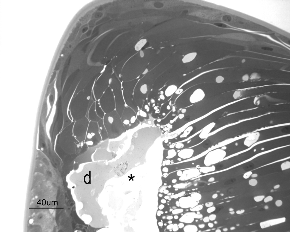 Figure 3.  Pre-equatorial semi-thin section of the lens from a 4-week-old duck. Vacuolated cells lined a cavity (*) in the anterior part of the lens containing liquefactive material. Lens fibres were irregular in diameter and dishomogeneous. A degenerated cell (d) is present within the cavity. Toluidine blue staining.