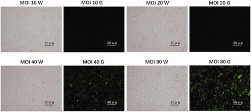Figure 2. Transduction rate of lentiviral plasmid in microglia. Neonatal rat microglia were plated in six-well plates with complete medium 24 h prior infection. Next day, microglia were infected with IRE1 overexpressed lentivirus at different multiplicity of infection (MOI) value (10–80) and incubated for 12 h. Microglia were gathered 72 h after transfection, and transduction efficiency was measured with an inverted fluorescence microscopy (Olympus, Tokyo, Japan). Green signal represents infected cells. Transduction rate was approximately 90% at an MOI of 80. W: observation under white light; G: observation under green light.