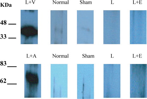 Figure 1.  Expression of VEGF165 and Ang1 protein 2 weeks after surgery.