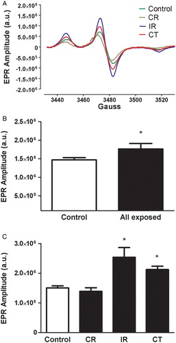 Figure 1 Representative EPR spectroscopy spectrum obtained from blood collected from control, CR-, IR-, and CT-exposed workers, and incubated with the O2•−-sensitive spin probe, CMH (A). The EPR spectrum amplitude is directly proportional to the levels of O2•− in the sample. Summary data showing EPR spectrum amplitude in control individuals and all radiation-exposed workers (B) and the specific radiation-exposed subgroups (CR, IR, and CT) (C). a.u. = arbitrary unit. Data represent the mean ± SEM. *P < 0.05 versus control and CR.